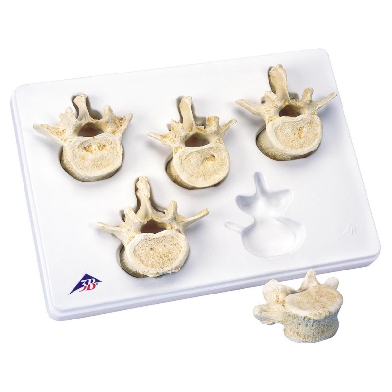 Lendenwirbelset 5 Stück