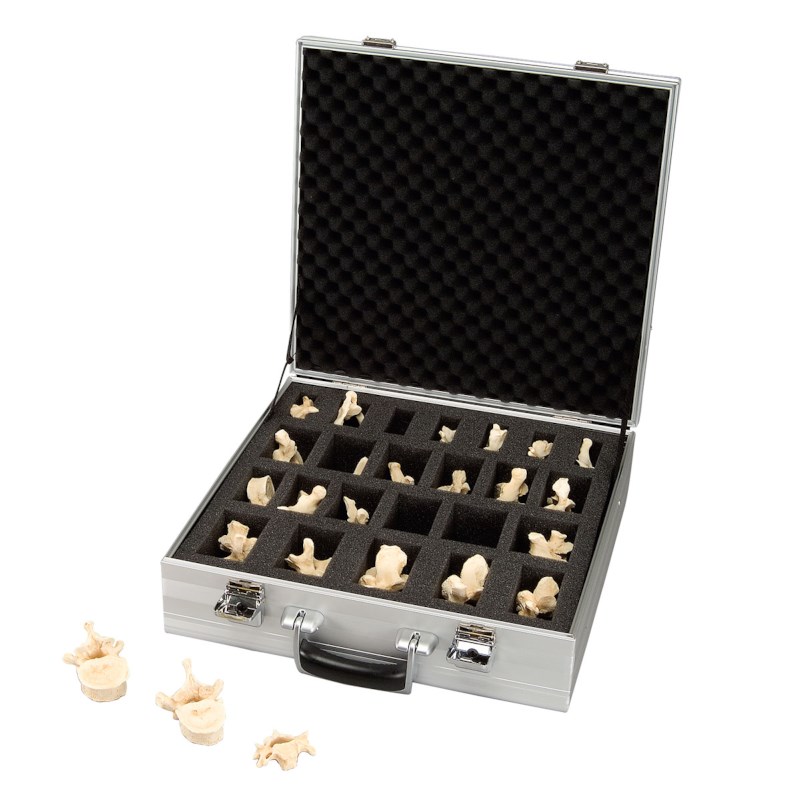 Wirbelset 24 Stück im Koffer