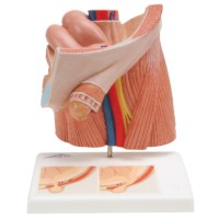 Leistenbruch (hernia), anatomische dds