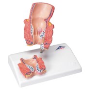 Modell Hämorrhoiden