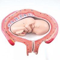 Uterus mit Foetus - 4. Monat