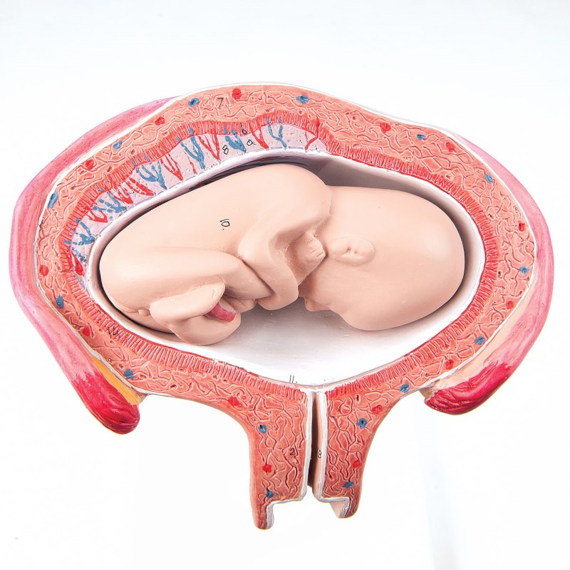 Uterus mit Foetus - 4. Monat