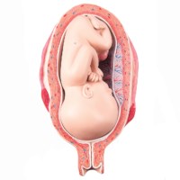 Uterus mit Foetus - 7. Monat