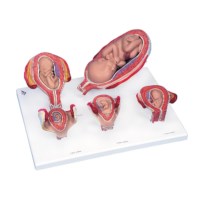 Modell Schwangerschaft Serie 5 Modelle