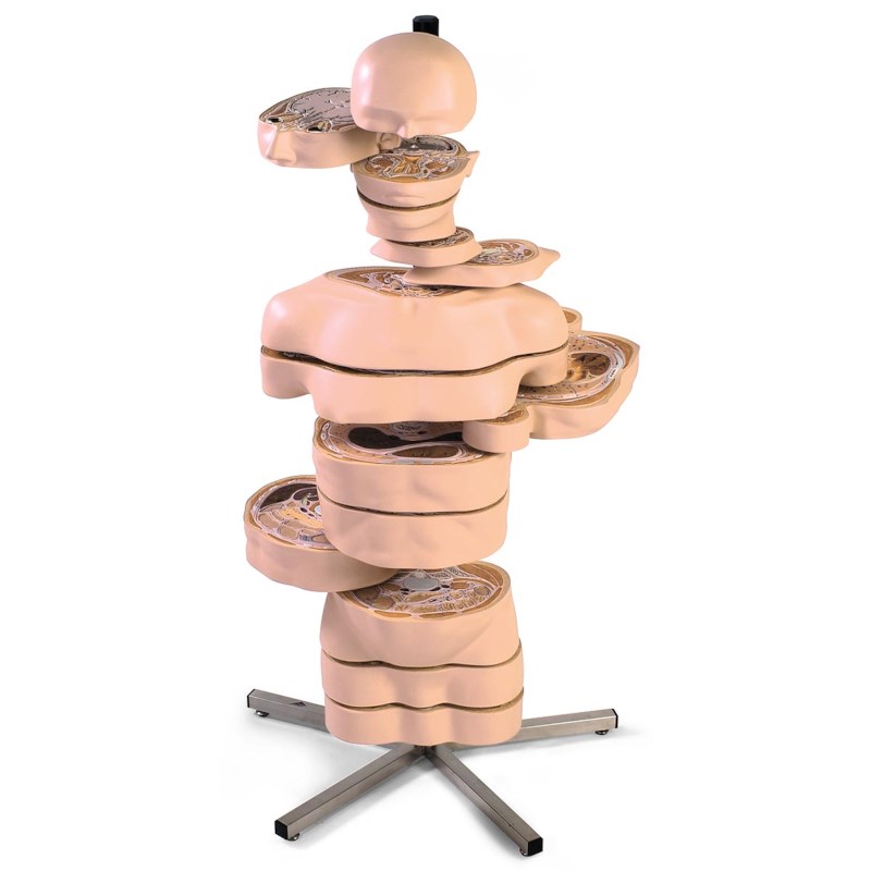 Torso MRI mit 15 Querschnitten