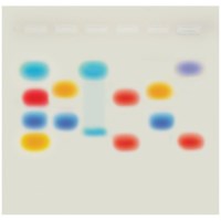 Verknüpfung von MINT-Bildung mit Agarosegel-Elektrophorese