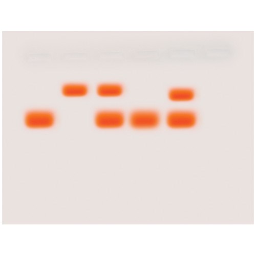 Das Geheimnis der krummen Blutzelle