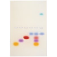 Das Prinzip und die Praxis der Agarose-Gelelektrophorese