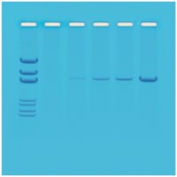 Die Grundlagen der PCR