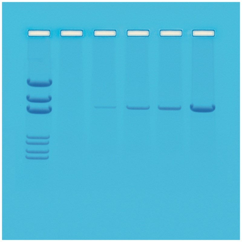 Die Grundlagen der PCR