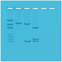 Kartierung von Restriktionsstellen auf Plasmid-DNA