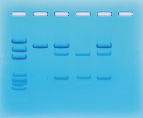 Edvotek - Nachweis von Krebsgenen