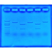 Edvotek - Using CRISPR To Treat Cystic Fibrosis #135
