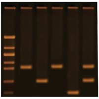 Nachweis von COVID-19 mittels Reverse-Transcription-PCR (RT-PCR)