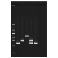 Wasserqualitätstests III: Multiplex-PCR-Tests von Wasserverunreinigungen