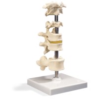 Wervelset van 6 stuks