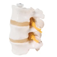 Lumbale wervels (3) , flexibel