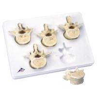 Wervelset lendenen 5 stuks