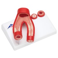Model arteriosclerosis