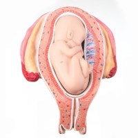 Uterus met foetus - 5e maand dwarligging