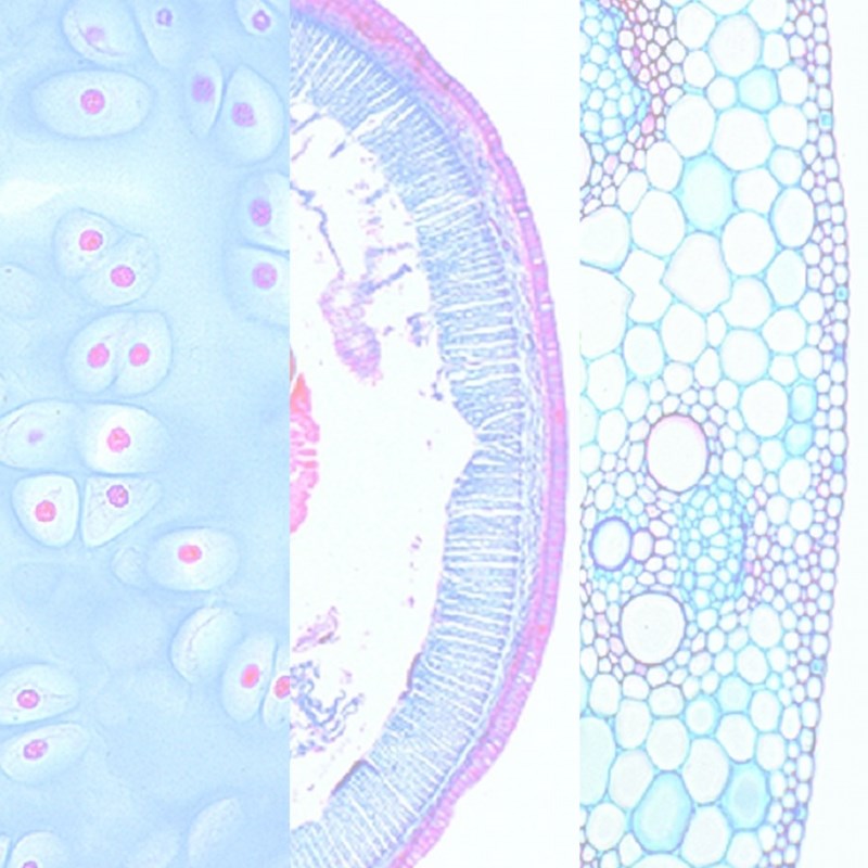 Preparaat Mucor Mucedo, zwarte schimmel | Techni Science ...
