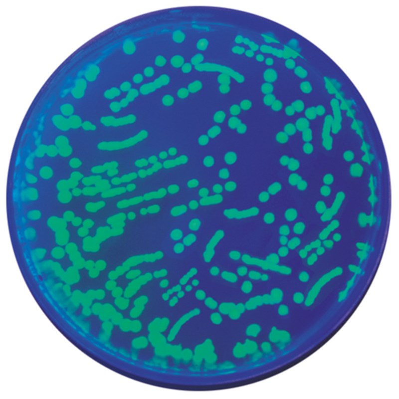 Transformatie E.coli met groen fluorescerend eiwit #223