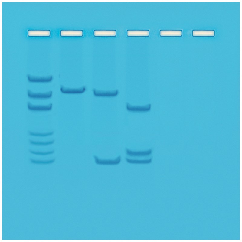 In kaart brengen van restrictieplaatsen op plasmide DNA