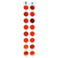 Simulated ABO Blood Typing #140